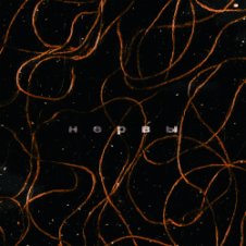 Обложка Лучнадежды – Нервы